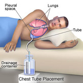 چست باتل نصر