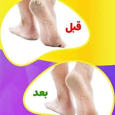 پاشنه پوش سیلیکونی FOOT CARE